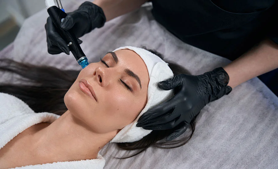 Woman getting microneedling treatment to her face