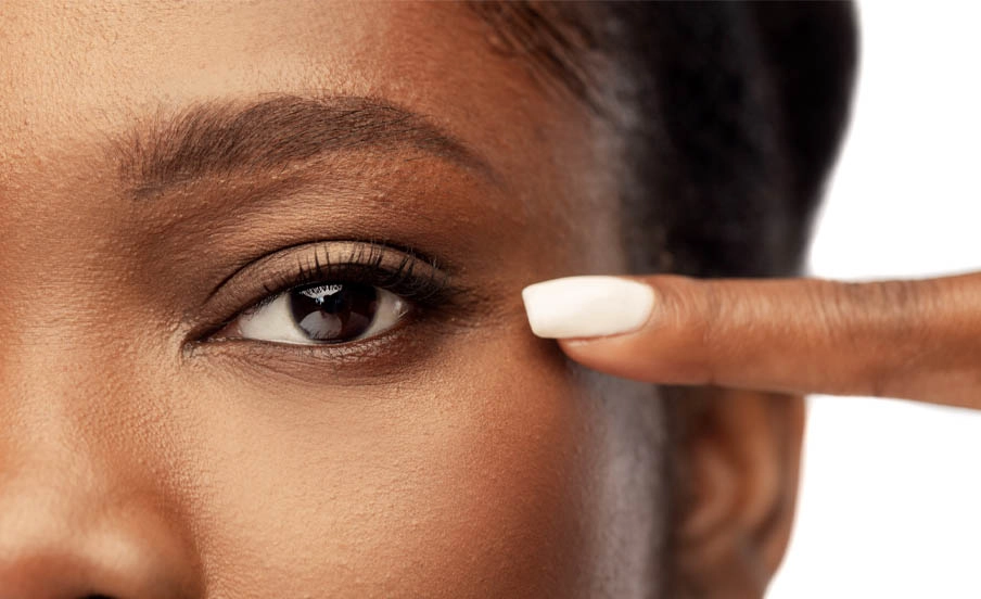 Blepharoplasty
